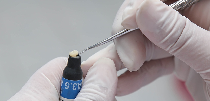 شعبة مواد طب الأسنان