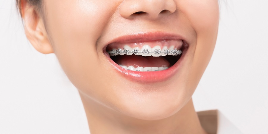 شعبة تقويم الأسنان