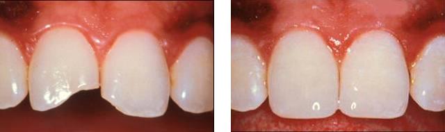 شعبة إصلاح الأسنان